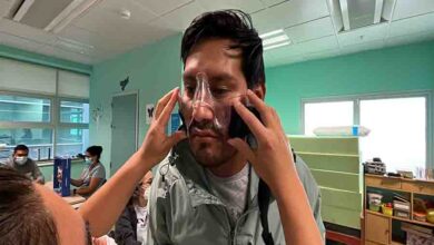 Photo of El Servicio de Medicina Física y Rehabilitación fabricó una innovadora órtesis facial para ayudar en su recuperación a paciente con quemaduras